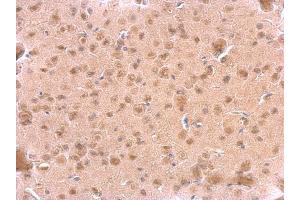 IHC-P Image ARF3 antibody detects ARF3 protein at cytosol on mouse fore brain by immunohistochemical analysis. (ARF3 Antikörper)