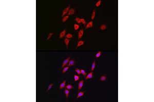 Immunofluorescence analysis of NIH/3T3 cells using METTL4 Rabbit pAb (ABIN6133091, ABIN6143773, ABIN6143774 and ABIN6224964) at dilution of 1:100 (40x lens).
