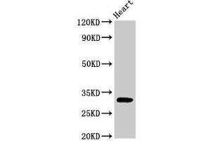 Western Blot Positive WB detected in: Rat heart tissue All lanes: PPP1R3B antibody at 2. (PPP1R3B Antikörper  (Regulatory Subunit 3B))