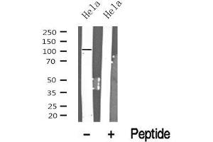Western blot analysis of PRK1/2 in lysates of Hela? (PRK1/2 Antikörper)