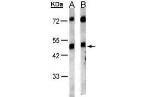 WB Image Sample(30 μg of whole cell lysate) A:HeLa S3, B:MOLT4, 10% SDS PAGE antibody diluted at 1:1000 (GRPR Antikörper)