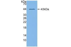 Western blot analysis of recombinant Mouse ADAM8. (ADAM8 Antikörper  (AA 145-493))