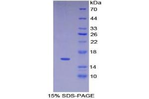 SDS-PAGE of Protein Standard from the Kit (Highly purified E. (KRT15 ELISA Kit)