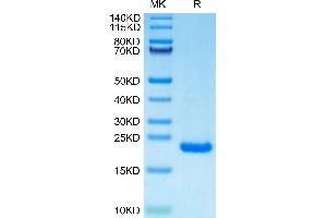 Human PRL-2 on Tris-Bis PAGE under reduced condition. (PTP4A2 Protein (AA 1-164) (His tag))