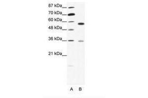 Image no. 1 for anti-GDP Dissociation Inhibitor 1 (GDI1) (C-Term) antibody (ABIN202545)