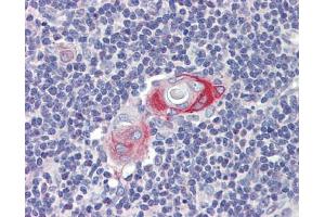Anti-CPXCR1 antibody IHC staining of human thymus. (CPXCR1 Antikörper  (Middle Region))