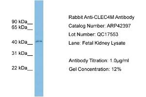 WB Suggested Anti-CLEC4M Antibody Titration:  0. (C-Type Lectin Domain Family 4, Member M (CLEC4M) (Middle Region) Antikörper)