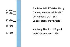 Western Blotting (WB) image for anti-C-Type Lectin Domain Family 4, Member M (CLEC4M) (Middle Region) antibody (ABIN2775394)