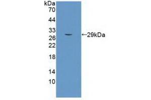 Detection of Recombinant SEMA5B, Human using Monoclonal Antibody to Semaphorin 5B (SEMA5B) (SEMA5B Antikörper  (AA 350-602))