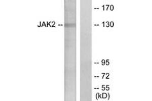 Western blot analysis of extracts from HT-29 cells, using JAK2 (Ab-1007) Antibody. (JAK2 Antikörper  (AA 981-1030))