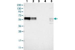 Western blot analysis of Lane 1: RT-4, Lane 2: U-251 MG, Lane 3: Human Plasma, Lane 4: Liver, Lane 5: Tonsil with ZC3H15 polyclonal antibody . (ZC3H15 Antikörper)