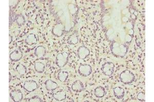 Immunohistochemistry of paraffin-embedded human small intestine tissue using ABIN7168517 at dilution of 1:100 (SCAPER Antikörper  (AA 1109-1400))