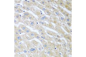 Immunohistochemistry of paraffin-embedded human liver using UCHL3 antibody at dilution of 1:100 (40x lens). (UCHL3 Antikörper)