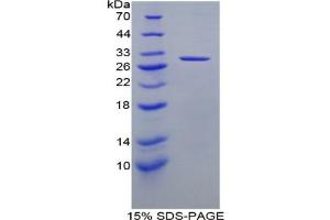 SDS-PAGE analysis of Rat DLD Protein. (DLD Protein)