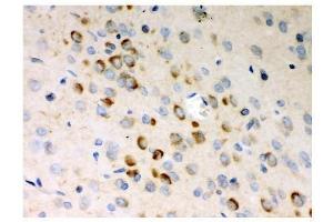 IHC analysis of Stathmin 1 using anti-Stathmin 1 antibody (ABIN3043301).