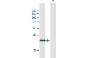 Western Blotting (WB) image for anti-Zinc Finger, AN1-Type Domain 3 (ZFAND3) (AA 1-227) antibody (ABIN949562)