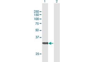 Western Blot analysis of ZFAND3 expression in transfected 293T cell line by ZFAND3 MaxPab polyclonal antibody. (ZFAND3 Antikörper  (AA 1-227))