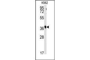 Image no. 1 for anti-Replication Factor C (Activator 1) 2, 40kDa (RFC2) (N-Term) antibody (ABIN357963) (RFC2 Antikörper  (N-Term))