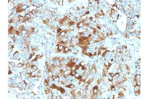 Formalin-fixed, paraffin-embedded human Adrenal Gland stained with Chromogranin A Monoclonal Antibody (CHGA/765). (Chromogranin A Antikörper)