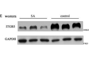 The expressions of H19 and integrin β3 (ITGB3) decrease in human embryonic chorion tissue of spontaneous abortion. (GAPDH Antikörper)