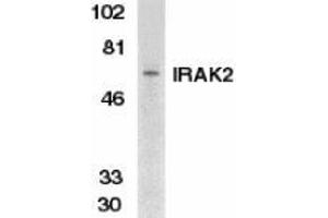 Western blot analysis of IRAK2 in K562 whole cell lysate with AP30441PU-N IRAK2 antibody at 1/500 dilution. (IRAK2 Antikörper  (C-Term))