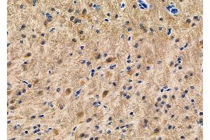 ABIN6263544 and ABIN6266651 at 1/100 staining Mouse brain tissue by IHC-P.