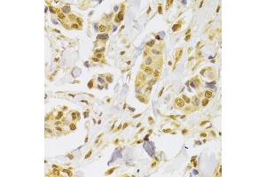 Immunohistochemistry (IHC) image for anti-Snail Family Zinc Finger 2 (SNAI2) (AA 126-268) antibody (ABIN6148181)