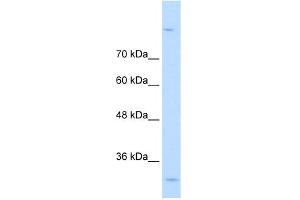 WB Suggested Anti-MPPED2 Antibody Titration:  0. (MPPED2 Antikörper  (C-Term))