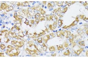 Immunohistochemistry of paraffin-embedded Human stomach using SLC30A1 Polyclonal Antibody at dilution of 1:100 (40x lens). (SLC30A1 Antikörper)