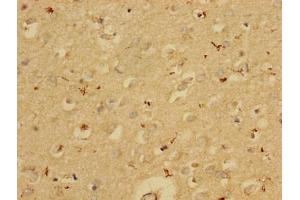 Immunohistochemistry of paraffin-embedded human brain tissue using ABIN7163532 at dilution of 1:100 (PAI1 Antikörper  (AA 24-398))