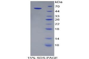 SDS-PAGE analysis of Rat Cathepsin A Protein. (CTSA Protein)