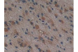 Immunohistochemistry (IHC) image for anti-Proteasome (Prosome, Macropain) 26S Subunit, Non-ATPase, 9 (PSMD9) (AA 2-223) antibody (ABIN7442213)