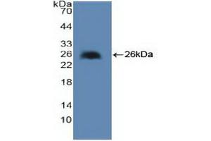 Western blot analysis of recombinant Human cPLA2. (PLA2G4A Antikörper  (AA 1-178))