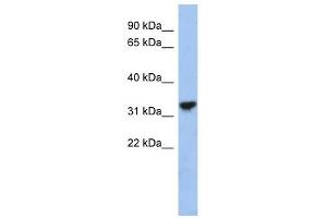 CYC1 antibody used at 1 ug/ml to detect target protein. (Cytochrome C1 Antikörper  (Middle Region))