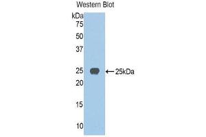 Western Blotting (WB) image for anti-Jagged 1 (JAG1) (AA 836-1047) antibody (ABIN1859518) (JAG1 Antikörper  (AA 836-1047))