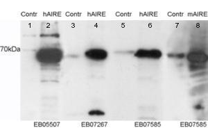 Western Blotting (WB) image for anti-DENN/MADD Domain Containing 4C (DENND4C) (C-Term) antibody (ABIN2790996)