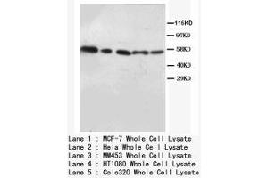 Image no. 2 for anti-V-Akt Murine Thymoma Viral Oncogene Homolog 1/2 (AKT1/2) (N-Term) antibody (ABIN1494209) (AKT1/2 Antikörper  (N-Term))
