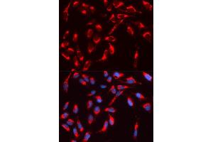 Immunofluorescence analysis of U2OS cell using WASL antibody. (Neural Wiskott-Aldrich syndrome protein (WASL) (AA 1-250) Antikörper)