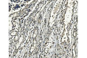 IHC analysis of XPD/ERCC2 using anti-XPD/ERCC2 antibody (ABIN7602458).