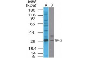 Image no. 1 for anti-Hepatitis A Virus Cellular Receptor 2 (TIM 3) (AA 100-200) antibody (ABIN208461) (TIM3 Antikörper  (AA 100-200))