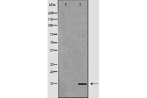 Western blot analysis of extracts of Caco-2 lysate, using CCL21 antibody. (CCL21 Antikörper  (C-Term))