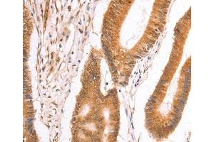 Immunohistochemistry (IHC) image for anti-Tax1 (Human T-Cell Leukemia Virus Type I) Binding Protein 1 (TAX1BP1) antibody (ABIN2828089)