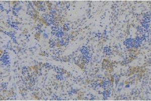 ABIN6279701 at 1/100 staining Human lymph node tissue by IHC-P. (CD164 Antikörper  (Internal Region))