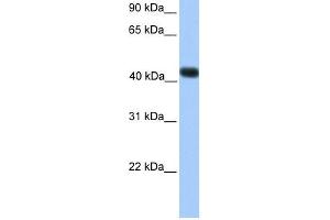 WB Suggested Anti-SSBP4 Antibody Titration:  0. (SSBP4 Antikörper  (C-Term))