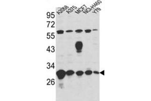 Western Blotting (WB) image for anti-Endoplasmic Reticulum Protein 29 (ERP29) antibody (ABIN3001703)