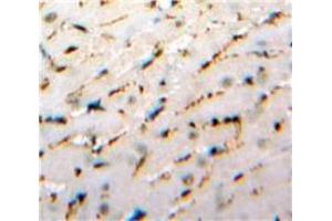 Used in DAB staining on fromalin fixed paraffin-embedded Heart tissue