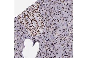 Immunohistochemical staining of human pancreas with GPKOW polyclonal antibody  shows strong nuclear positivity in exocrine glandular cells and islet cells at 1:50-1:200 dilution.