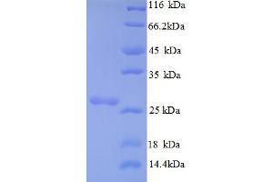 SDS-PAGE (SDS) image for Vacuolar Protein Sorting 13 Homolog B (Yeast) (VPS13B) (AA 4-200), (partial) protein (His tag) (ABIN5713014) (VPS13B Protein (AA 4-200, partial) (His tag))