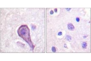 Immunohistochemistry analysis of paraffin-embedded human brain tissue, using Rhodopsin (Ab-334) Antibody. (Rhodopsin Antikörper  (AA 299-348))