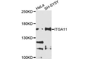 Western blot analysis of extracts of various cell lines, using ITGA11 antibody (ABIN6003790) at 1/1000 dilution.